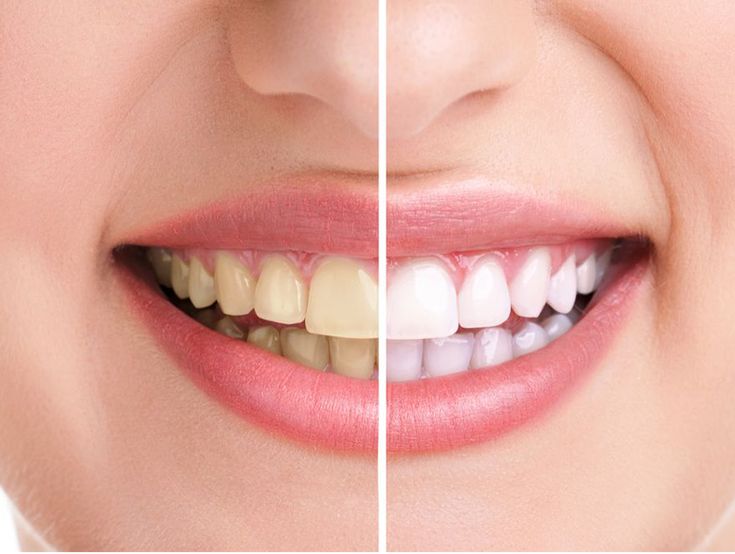 Dental consultation